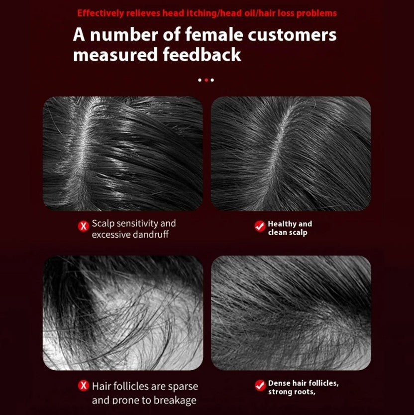 Zentrava Premium™ Brush - Deep Scalp Stimulation - Zentrava