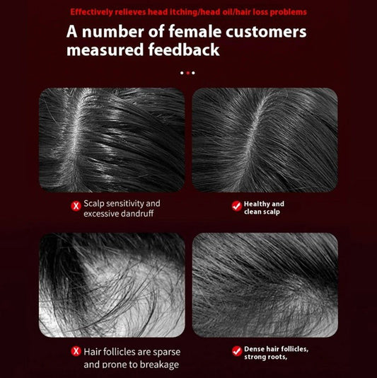 Zentrava Premium™ Brush - Deep Scalp Stimulation - Zentrava